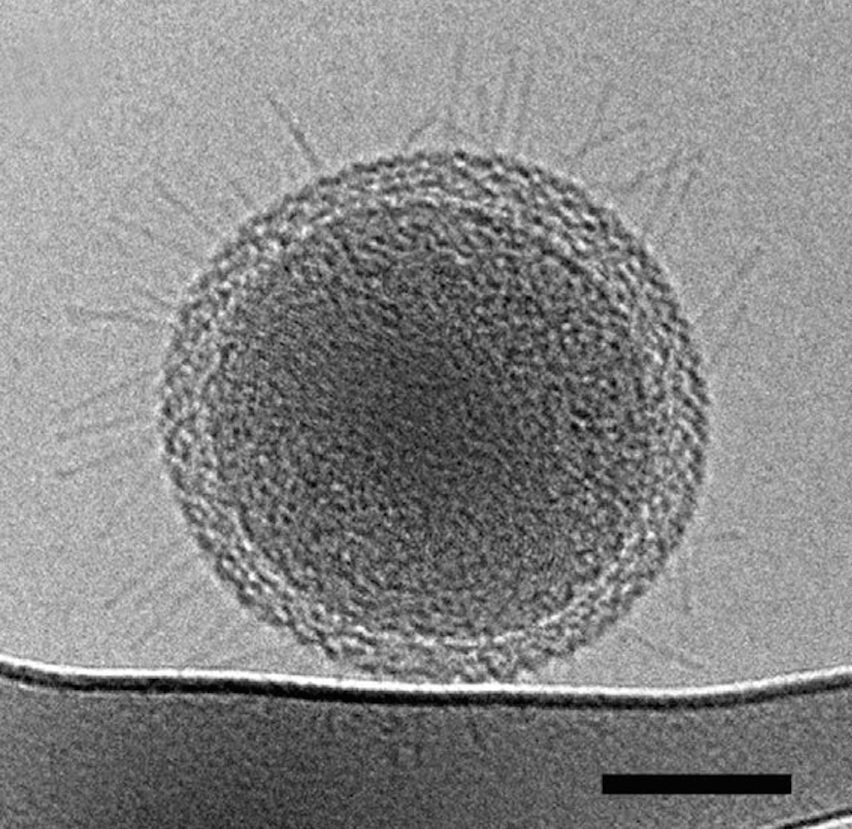 Самый маленький микроб в мире под микроскопом. Самая маленькая бактерия в мире. Рибосомы в микроскопе. Самые маленькие микробы в микроскоп.